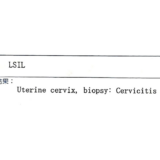 【痛みはまさかの……】子宮頸がんの精密検査の体験談
