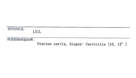 【痛みはまさかの……】子宮頸がんの精密検査の体験談